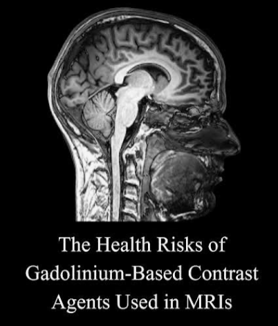 Gadolinium Harm What you need to share.